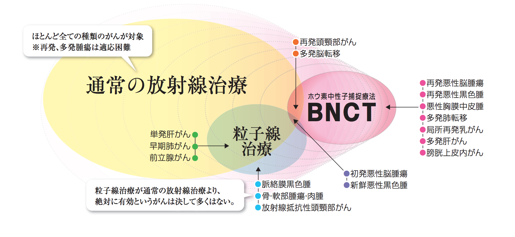 硼中子俘获疗法（bnct）